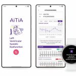 تشخیص زودهنگام نارسایی قلبی و ارتقای سلامت روان با فناوریهای پوشیدنی سامسونگ